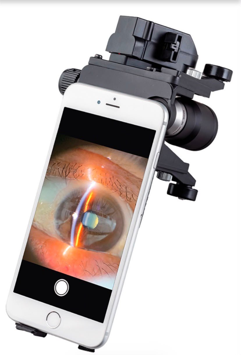 MS1 Mobile slit lamp